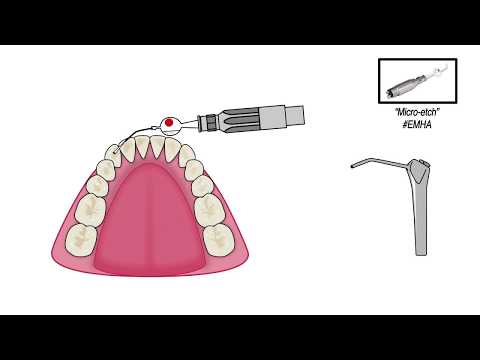 Ortho Flextech  Retainerdraht